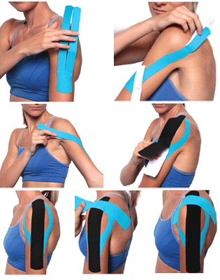 kinesio tape postural shoulder support