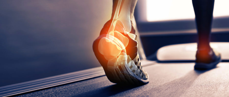 What are orthotics and how do they benefit you: Neuhaus Foot