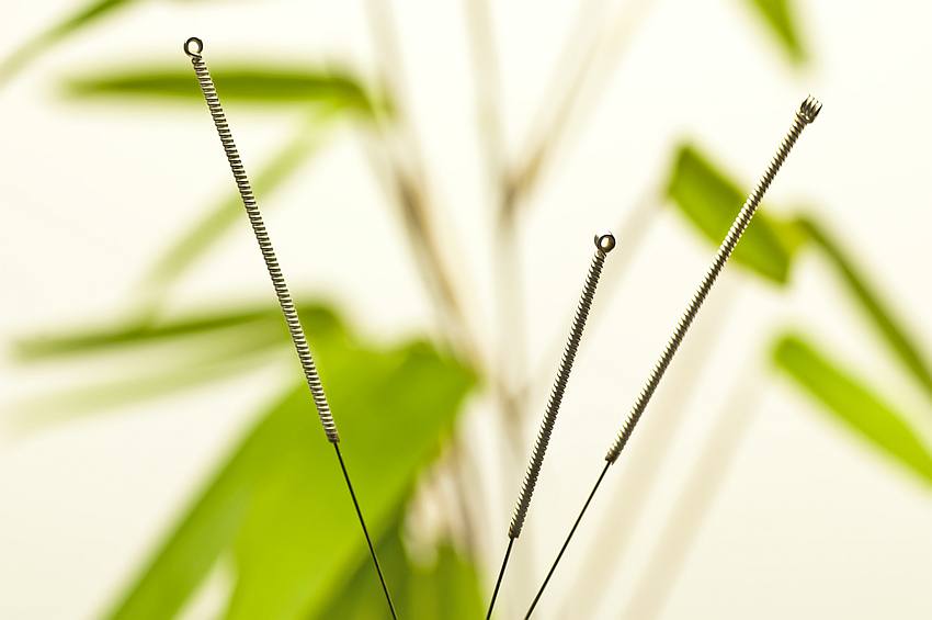 Acupuncture needle