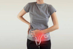 Pelvic Floor Dysfunction Physiotherapy